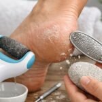 foot hard skin remover